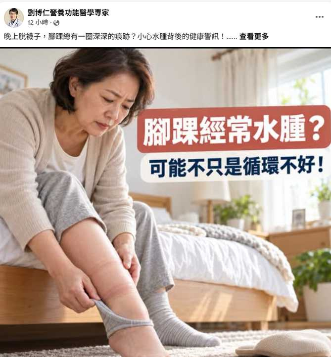 劉博仁醫師指出,腳踝水腫可能與靜脈循環不佳、心臟及腎臟疾病等因素有關。(圖/翻攝自臉書,劉博仁營養功能醫學專家)