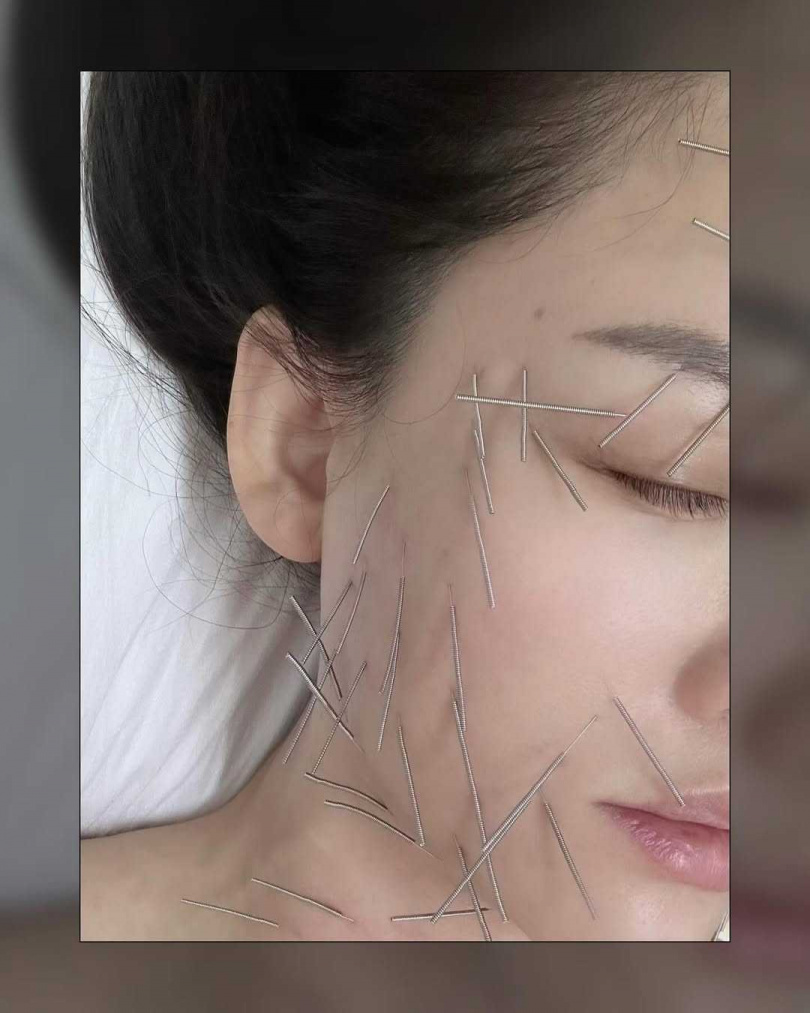 陳喬恩分享針雕畫面，相當驚悚。（圖／陳喬恩IG）
