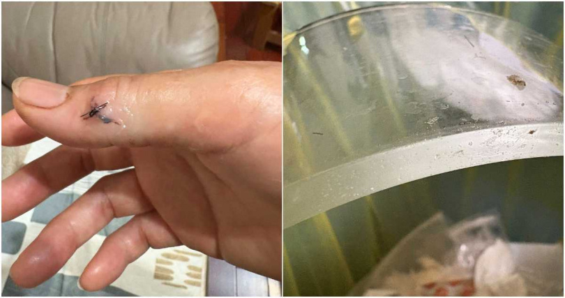 一名網友控訴，他在全聯換購的保鮮碗竟直接爆裂，導致手臂肌腱遭割斷，縫了好幾針。（圖／擷取自Facebook／全聯消費經驗老實說）