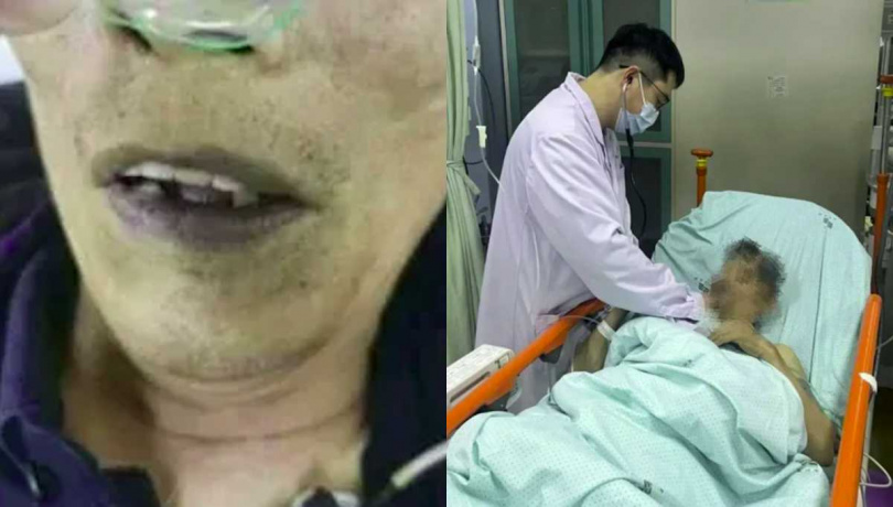 老翁全身發紫。（圖／翻攝自微博）