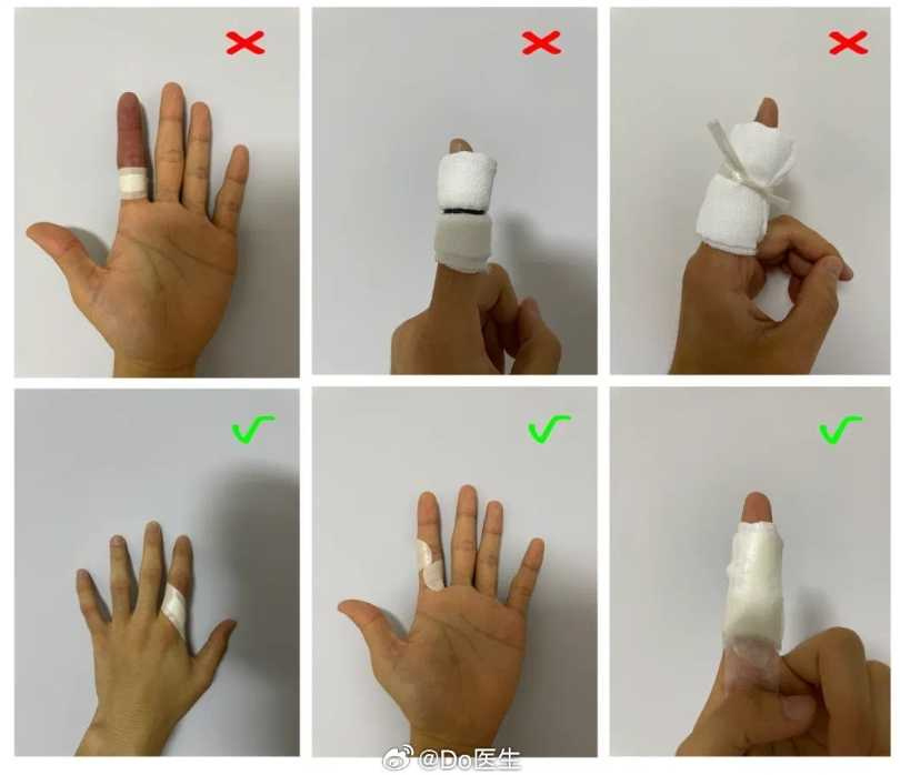 Do醫生分享錯誤和正確包紮方式。（圖／翻攝自微博／Do醫生）