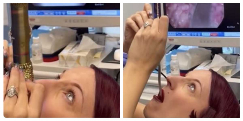 哥倫比亞大學醫師團隊以高畫質內視鏡記錄吞劍過程,清晰捕捉聲帶與食道反應。(圖/翻攝自 IG @ginminsky)