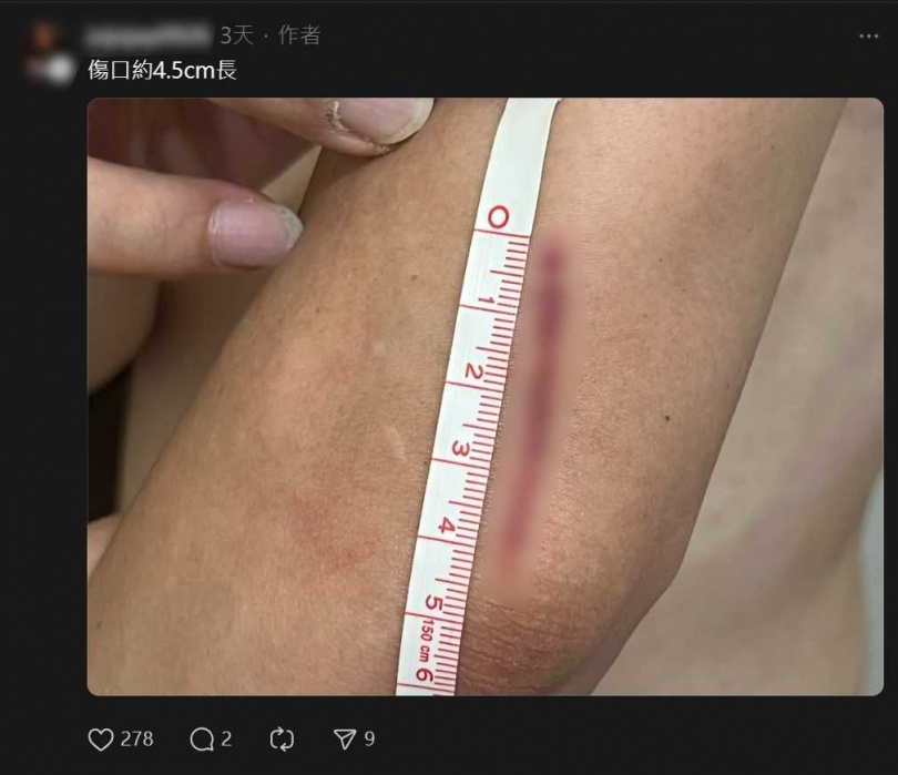 網友發文抱怨家人打流感疫苗,拔針的時候被針劃傷。(圖/翻攝自Threads)