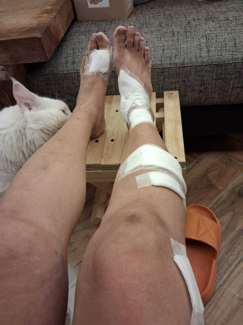 A小姐表示，自己在光復的租屋處嚴重受損，腳部也因此受傷，拖直到最近才去開刀治療，未料房東卻跟她表示，「領很多補助金對吧，分我一點」。（圖／民眾提供）