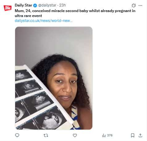 凱瑟琳坦言，雙胞胎出生後初期照顧工作幾乎由她獨自承擔，但她相信「沒有什麼是媽媽撐不過的」。（圖／翻攝自X，@dailystar）