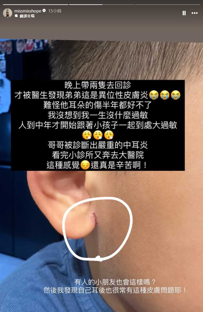 林可彤小孩罹患異位性膚炎,所以耳朵裂開情況才都沒改善。(圖/翻攝自林可彤IG)