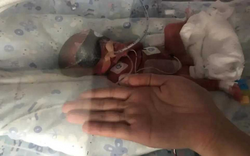 第1個寶寶屬於「超低早產兒」。（圖／翻攝自極目新聞）