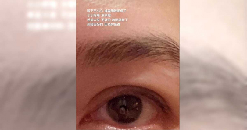 蔡依珊稱被狗抓傷。（圖／翻攝蔡依珊IG）