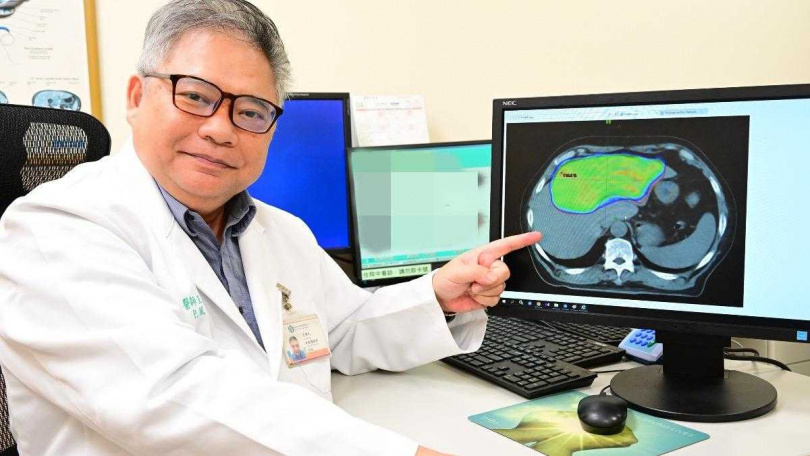 麻糬伯的肝臟內的腫瘤大小有如一顆排球。（圖／亞大附醫提供）