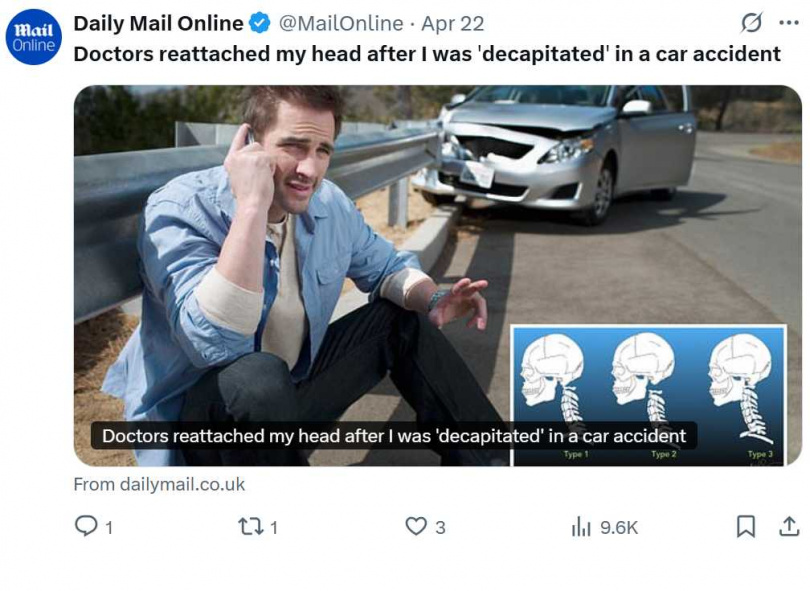 美國一名男子發生嚴重車禍，導致「內部斬首」，也就是頭顱與脊柱之間的韌帶與關節「完全分離」。（圖／翻攝自X）