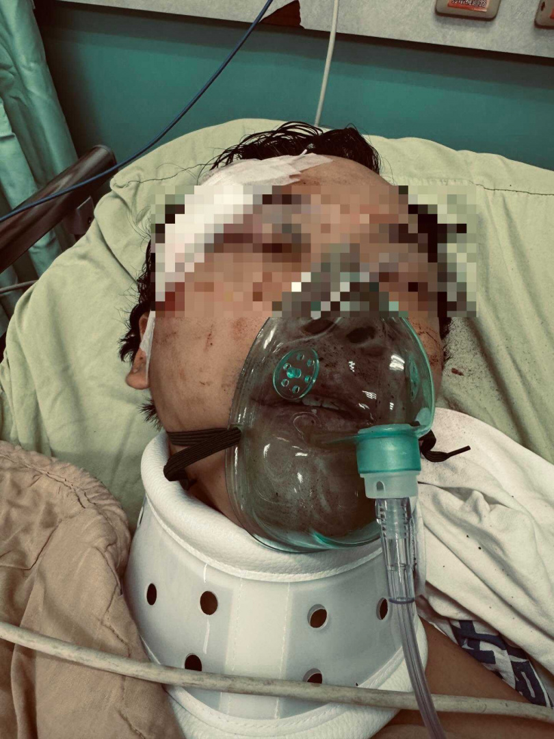 家屬在Threads上控訴，爸爸當《豆腐媽媽》替身從4層樓高鋼架摔下來。（圖／翻攝Threads／＠hoppychamp）