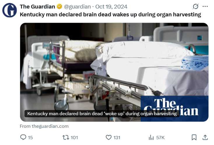 目前全美約有10萬人等待器官移植，平均每天13人因等不到器官而喪生。（圖／翻攝自X）