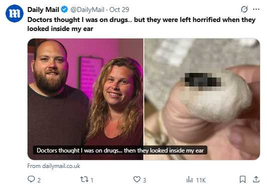 美國印第安納州男子布蘭登(右)與妻子席拉,耳朵藏蟲事件震驚網友。(圖/翻攝自X,@DailyMail)