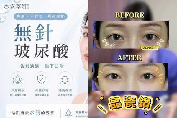 前員工A小姐指出,安萃妍主打的無針玻尿酸就是愛爾麗的獨有「晶磁鑽」技術,背後更可明顯看到愛爾麗的制服。(圖/民眾提供)