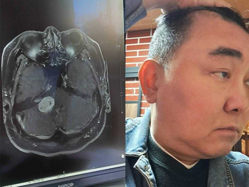 徐亨消失螢光幕多年，近期因為拍徒弟陳昶均的MV被發現變胖，4日他才公開自己過去得了腦腫瘤引發水腦症，緊急送醫動刀治療。（圖／翻攝自徐亨臉書）