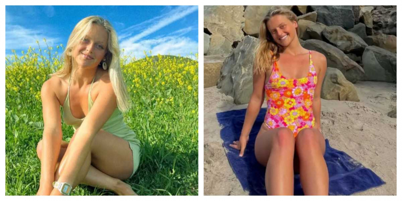 醫療團隊進行長達10小時手術,成功將博伊德的手臂接回,目前仍需再接受兩次手術。(圖/取自Instagram)