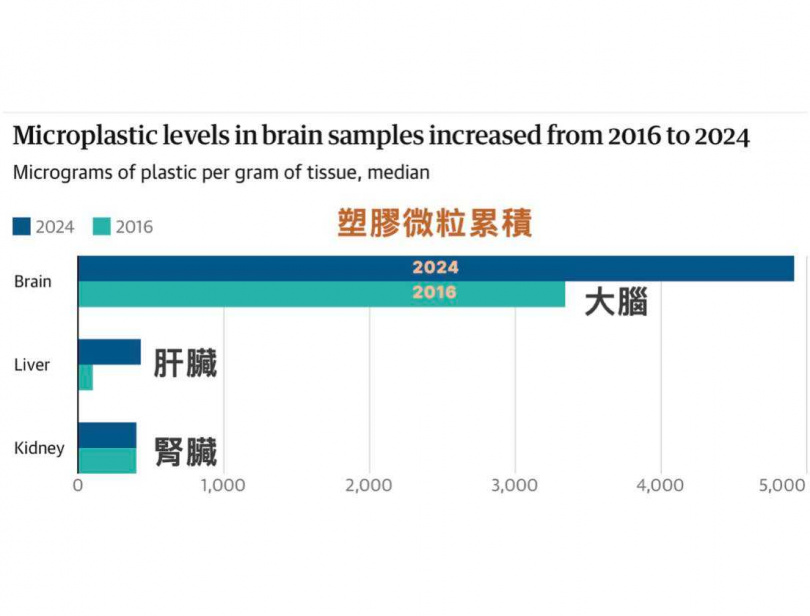 大腦是人體中最容易累積塑膠微粒的器官，失智症患者腦中的塑膠含量甚至比正常人高出3到6倍。（圖／翻攝自臉書／減重醫師蕭捷健）