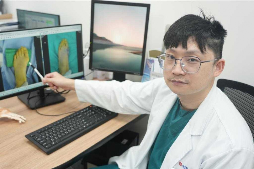 光田綜合醫院骨科醫師洪煒竣提醒，拇趾外翻如拖太久治療，最後恐致關節炎風險。（圖／温予菱攝）