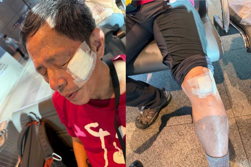 劉克襄出國回台時在台中高鐵站跌倒,受傷後獲得各方善心人士協助,他也特地發文感謝。(圖/翻攝自劉克襄臉書)