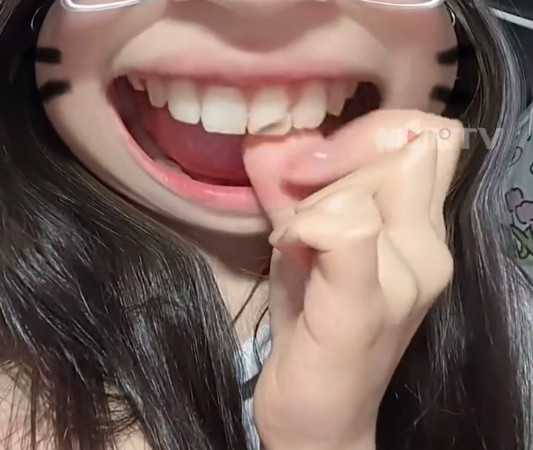 女子網購14元人民幣牛肉乾，卻花1300元人民幣補牙。（圖／翻攝自微博）