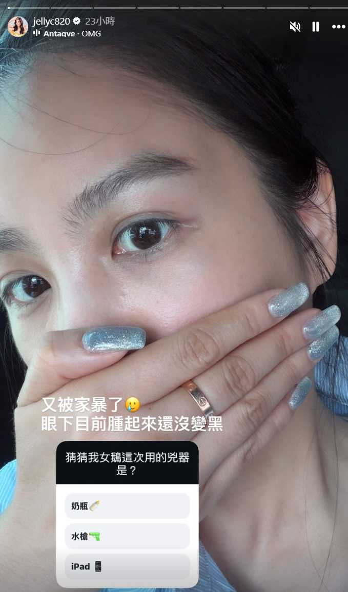 楊晨熙曬出臉部傷勢照,透露女兒手中的iPad意外砸中眼下顴骨,當場腫了起來。(圖/翻攝自IG,jellyc820)