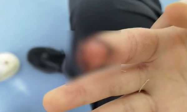 大陸7歲女童在餵食汗血寶馬時，不慎被馬兒咬傷右手食指。（圖／翻攝自微博）