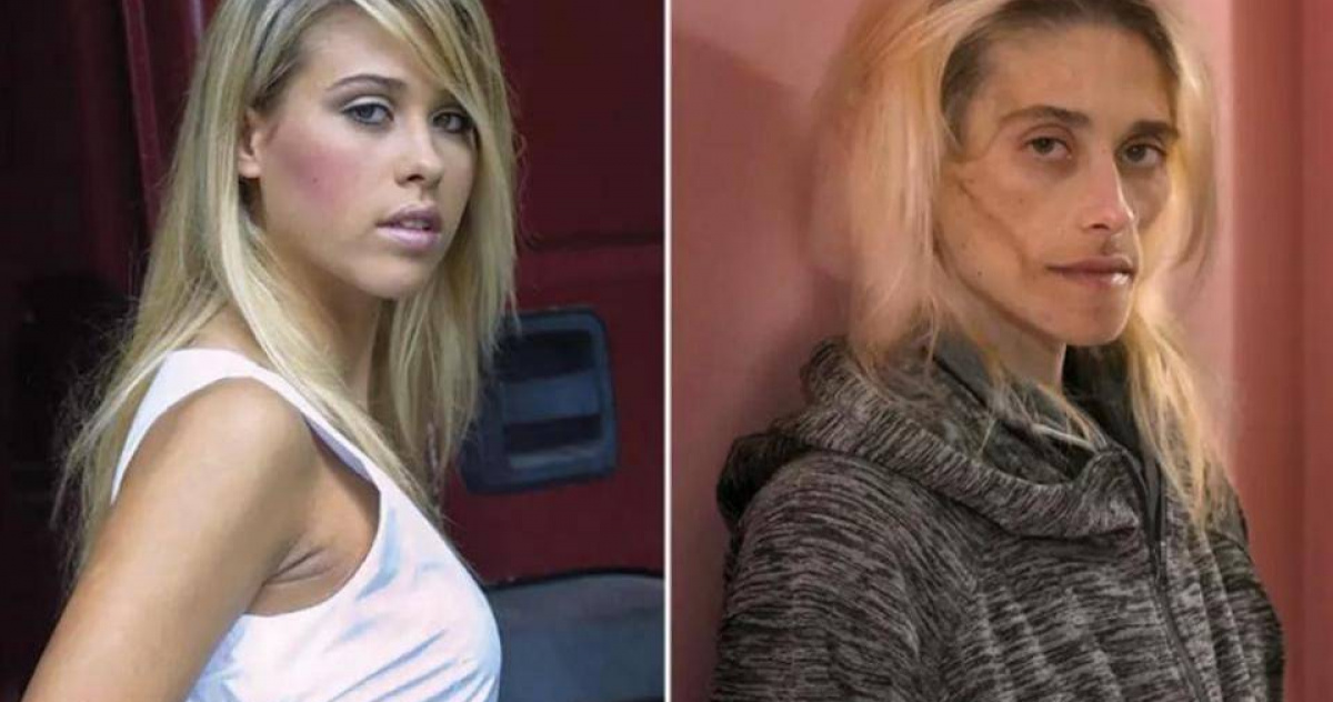 以色列35歲名模離世 被厭食症折磨13年牙掉光…病逝時僅23公斤 國際 CTWANT