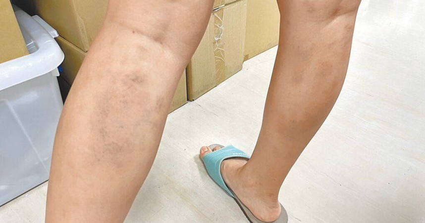 衛生福利部統計，2024年台灣家暴通報人數高達17萬9107件次。（圖／亞大醫院提供）