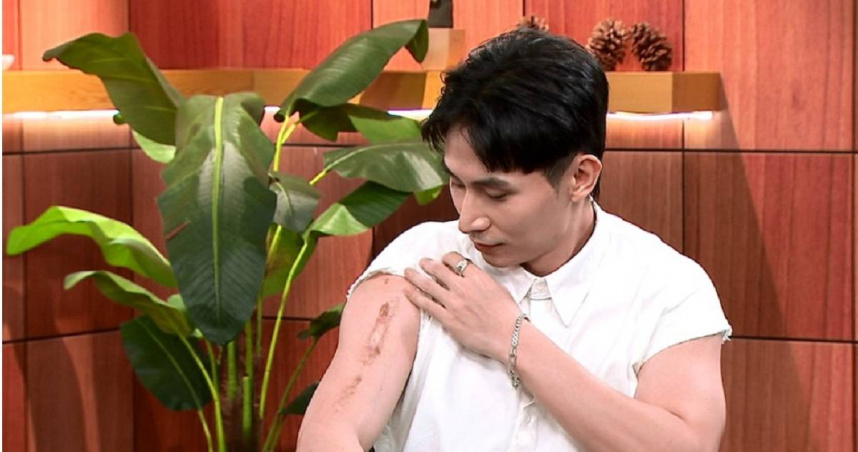 林家佑秀出開刀後手臂所留下的20公分疤痕。（圖／年代提供）