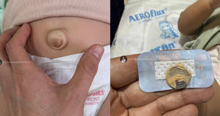 墨西哥一名小兒科醫師羅蘭多分享一起診間案例，點出長輩育兒迷思，恐釀危險後果。（圖／翻攝自臉書／Dr. Rolando Espinoza）