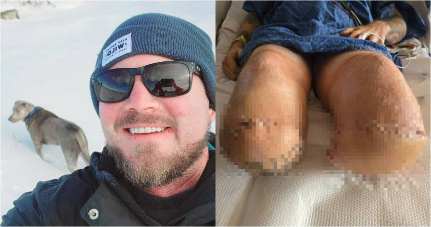 。（圖／翻攝FB／Max Armstrong ）