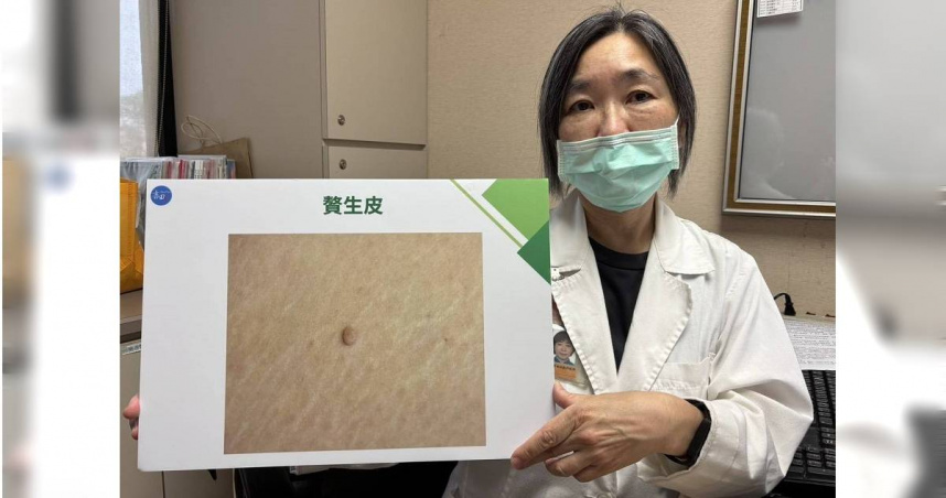書田診所整形美容科主任醫師黃季怡提醒，贅生皮若出現紅腫、感染甚至壞死等情況時，就應當心。（圖／書田診所提供）