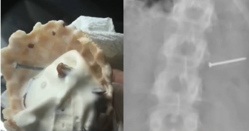 美國佛羅里達州一名女子去連鎖冰淇淋店買冰淇淋卻吃到金屬釘，造成她身體出狀況，甚至喪失生育能力。（圖／翻攝自YouTube／WESH 2 News）