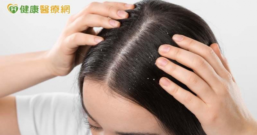 頭頂天天「飄雪花」洗頭也沒用？營養師推「6大維生素」養出健康頭皮