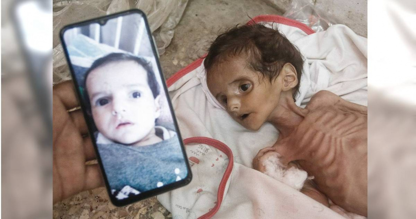 加薩地區出生不到6個月的嬰兒於當地時間6月27日死亡，讓家人相當悲痛。（圖／翻攝自臉書／TRT World）