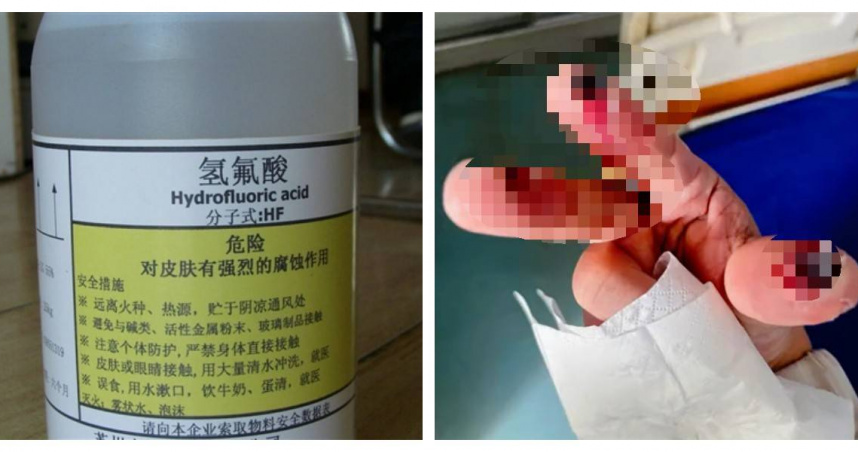 浙江一名女子散步時不慎踩破盛有氫氟酸的老化容器，最終因中毒過深不幸喪命。（示意圖／翻攝自快科技）