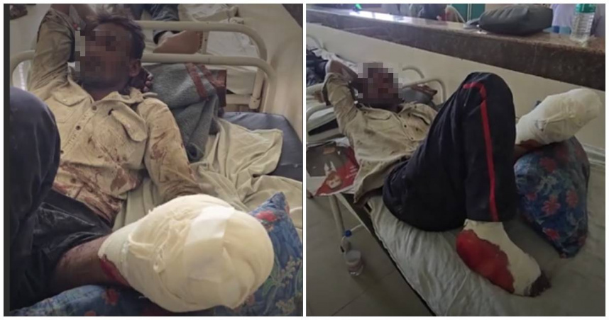 印度中央邦一名35歲工人在返家途中遭搶，搶匪將他拖上火車即將駛過的鐵軌意圖滅證，導致他的左腿被駛過的火車輾斷。（圖／翻攝Bhaskar English）