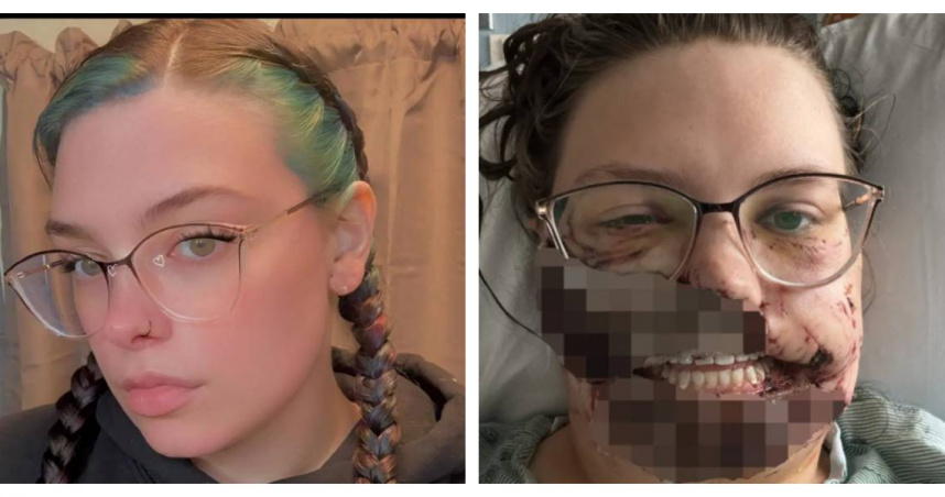 卡瑪戴維斯因臉部重創送醫治療，後續接受多次重建手術。（圖／翻攝自Gofundme）