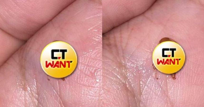 男子連續3天感到喉嚨不適，竟從口中咳出1隻不明生物。（圖／翻攝自Khaosod）