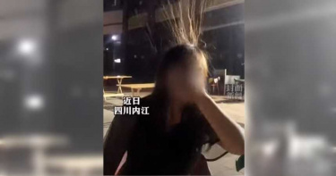 長髮妹吃宵夜吃到「炸毛」 專家:死亡風險高
