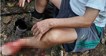 民眾爬柴山遭流彈貫穿腳踝 軍方:暫停實彈演訓