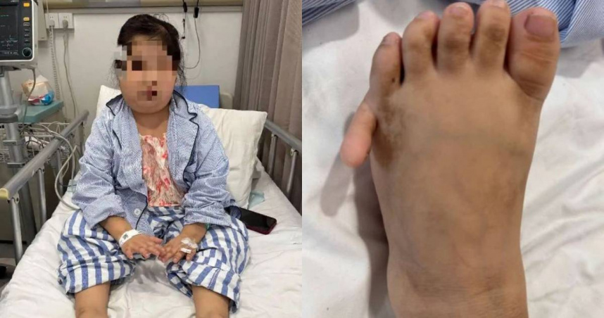 小蕓自幼發育明顯異常，身形與外觀長期停留在約6至7歲兒童階段，且雙足出現多指畸形。（圖／翻攝自揚子晚報）