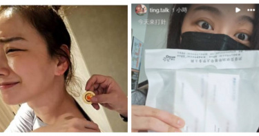 邵庭分享蕁麻疹復發狀況，坦言情緒一度潰堤。（圖／翻攝自IG，ting.talk）