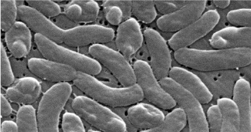2005年由美國疾病管制與預防中心提供的創傷弧菌（Vibrio vulnificus）電子顯微鏡影像。（圖／達志／美聯社）