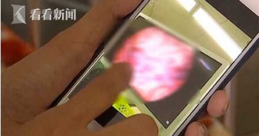 男童患罕病瘋狂流「半桶鮮血」 母割肝救兒:為了他我什麼都願意做!