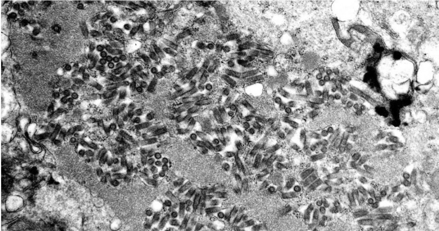 密西根州衛生部門於美東時間26日表示，1名於去年12月接受器官移植的當地居民，因移植的新器官帶有狂犬病病毒而感染死亡。（圖／達志／美聯社）