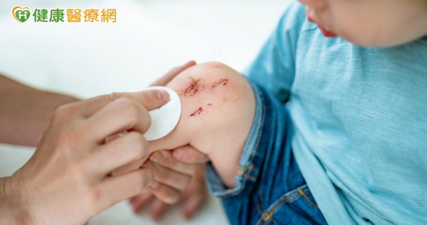 碘酒含1成分要注意　醫揭消毒用品選擇法則