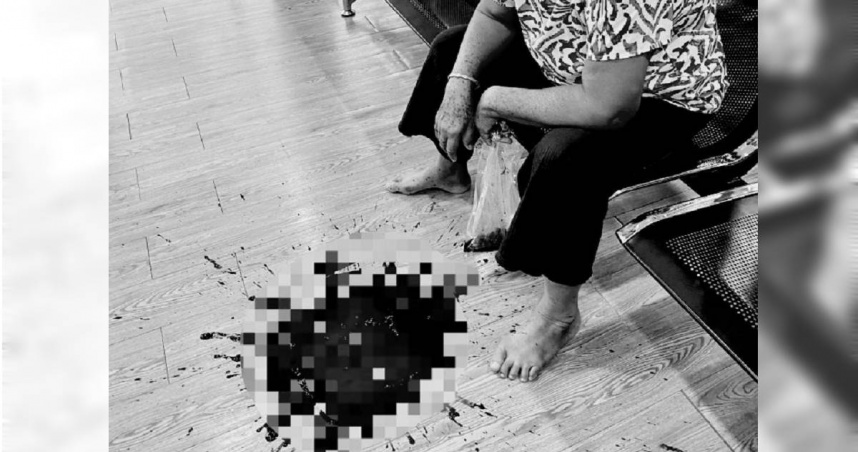 泰國一名老婦日前因胃痛就醫，診斷出胃炎後醫師開藥治療，但她狂吃消炎止痛藥，3天後竟吐出近1公升鮮血，醫師曬出驚悚畫面示警。（圖／翻攝自臉書／คลินิกเวชกรรมแพทย์คิมหันต์）