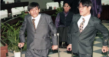 感性告白離世兄長「我愛你」!亞洲首對連體嬰分割40周年 展現強韌生命力