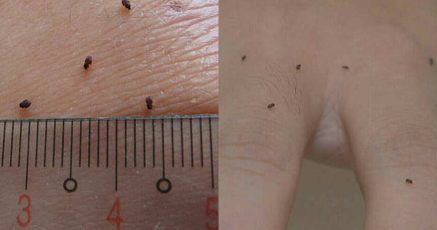 有網友提醒，前往救援的「鏟子超人」及志工，務必攜帶專門防小黑蚊的防蚊液。（圖／翻攝自Threads「wayen0610」）